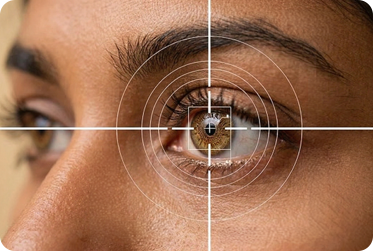 Refractive Surgeries