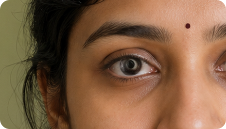 Lens Dislocation